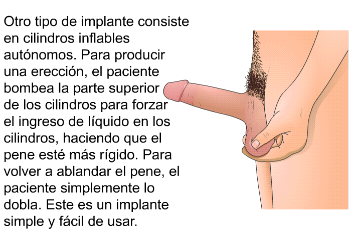 Otro tipo de implante consiste en cilindros inflables aut�nomos. Para producir una erecci�n, el paciente bombea la parte superior de los cilindros para forzar el ingreso de l�quido en los cilindros, haciendo que el pene est� m�s r�gido. Para volver a ablandar el pene, el paciente simplemente lo dobla. Este es un implante simple y f�cil de usar.