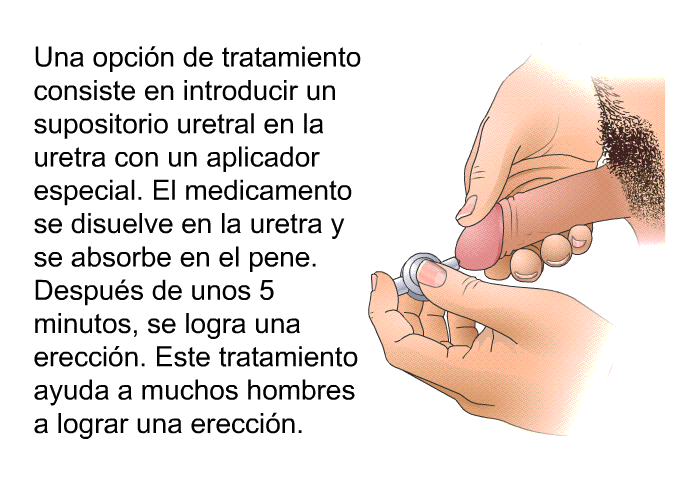 Una opci�n de tratamiento consiste en introducir un supositorio uretral en la uretra con un aplicador especial. El medicamento se disuelve en la uretra y se absorbe en el pene. Despu�s de unos 5 minutos, se logra una erecci�n. Este tratamiento ayuda a muchos hombres a lograr una erecci�n.