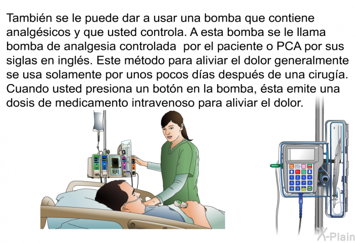 Tambi�n se le puede dar a usar una bomba que contiene analg�sicos y que usted controla. A esta bomba se le llama bomba de analgesia controlada por el paciente o PCA por sus siglas en ingl�s. Este m�todo para aliviar el dolor generalmente se usa solamente por unos pocos d�as despu�s de una cirug�a. Cuando usted presiona un bot�n en la bomba, �sta emite una dosis de medicamento intravenoso para aliviar el dolor.