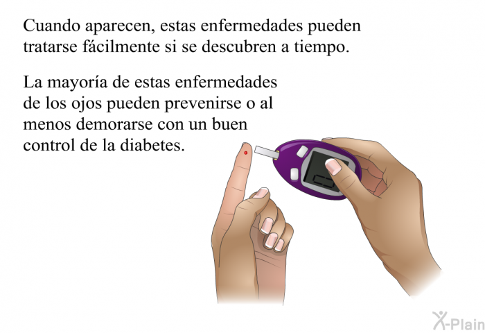 Cuando aparecen, estas enfermedades pueden tratarse fcilmente si se descubren a tiempo. La mayora de estas enfermedades de los ojos pueden prevenirse o al menos demorarse con un buen control de la diabetes.