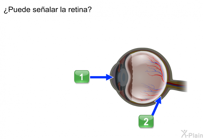 ¿Puede sealar la retina?