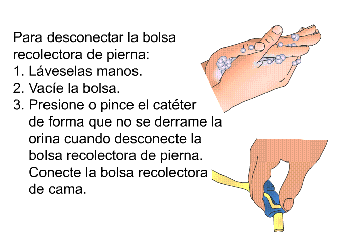 Para desconectar la bolsa recolectora de pierna:  Lveselas manos. Vace la bolsa.  Presione o pince el catter de forma que no se derrame la orina cuando desconecte la bolsa recolectora de pierna. Conecte la bolsa recolectora de cama.
