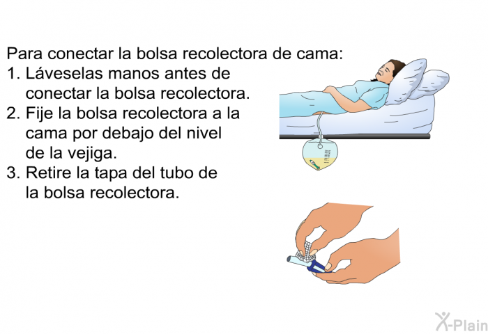 Para conectar la bolsa recolectora de cama:   Lveselas manos antes de conectar la bolsa recolectora.  Fije la bolsa recolectora a la cama por debajo del nivel de la vejiga.  Retire la tapa del tubo de la bolsa recolectora.