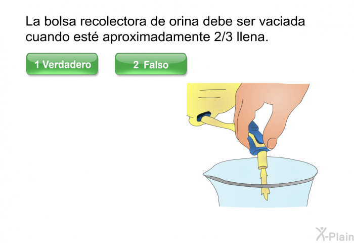 La bolsa recolectora de orina debe ser vaciada cuando est aproximadamente 2/3 llena.