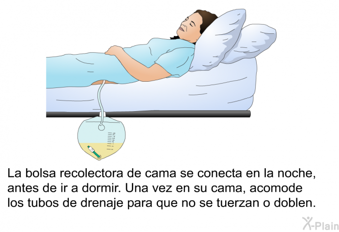 La bolsa recolectora de cama se conecta en la noche, antes de ir a dormir. Una vez en su cama, acomode los tubos de drenaje para que no se tuerzan o doblen..