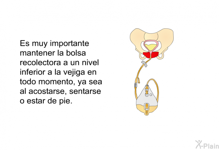 Es muy importante mantener la bolsa recolectora a un nivel inferior a la vejiga en todo momento, ya sea al acostarse, sentarse o estar de pie.