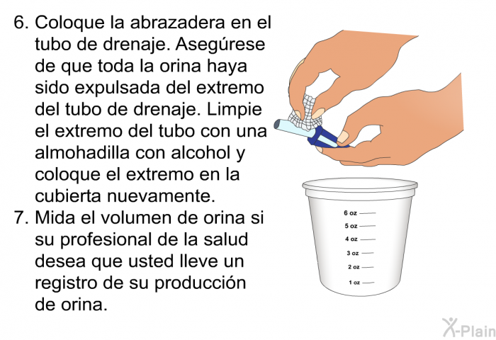 Coloque la abrazadera en el tubo de drenaje. Aseg�rese de que toda la orina haya sido expulsada del extremo del tubo de drenaje. Limpie el extremo del tubo con una almohadilla con alcohol y coloque el extremo en la cubierta nuevamente.  Mida el volumen de orina si su profesional de la salud desea que usted lleve un registro de su producci�n de orina.