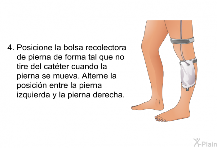 Posicione la bolsa recolectora de pierna de forma tal que no tire del catter cuando la pierna se mueva. Alterne la posicin entre la pierna izquierda y la pierna derecha.