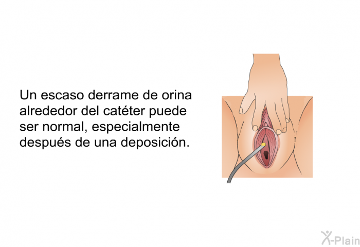 Un escaso derrame de orina alrededor del cat�ter puede ser normal, especialmente despu�s de una deposici�n.