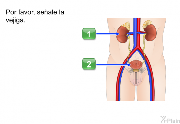 Por favor, seale la vejiga.