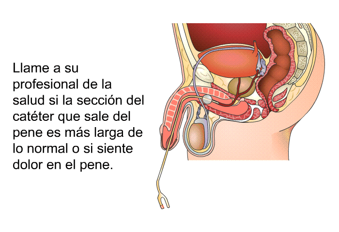 Llame a su profesional de la salud si la secci�n del cat�ter que sale del pene es m�s larga de lo normal o si siente dolor en el pene.