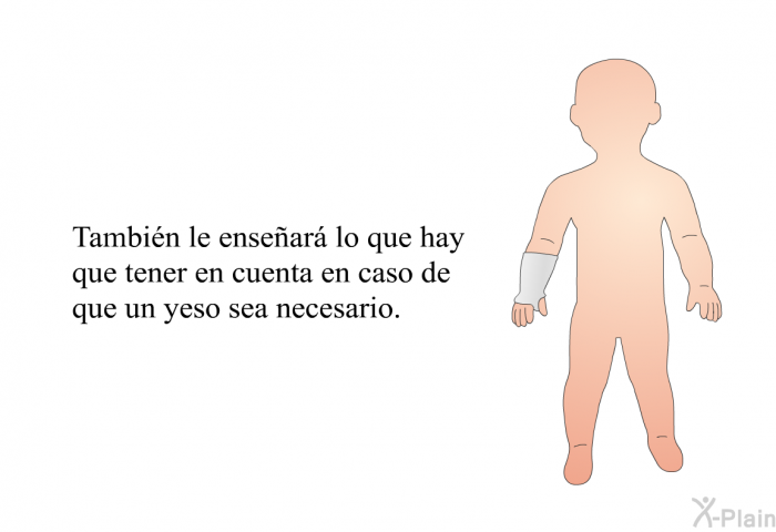 Tambin le ensear lo que hay que tener en cuenta en caso de que un yeso sea necesario.