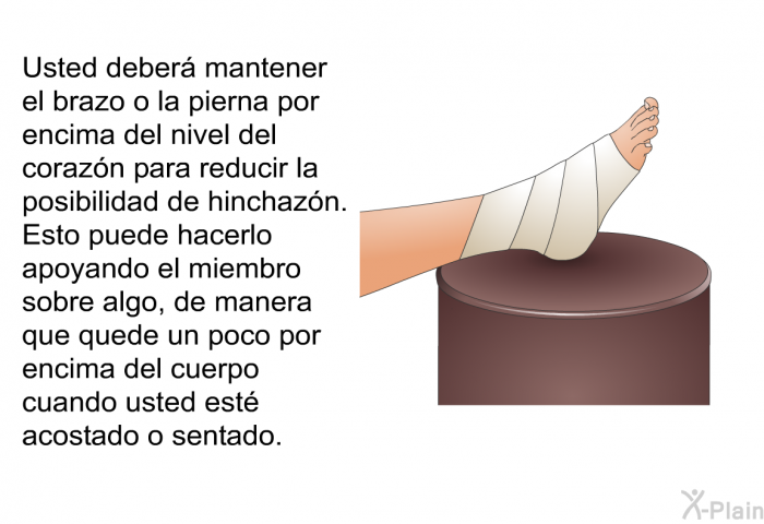 Usted deber mantener el brazo o la pierna por encima del nivel del corazn para reducir la posibilidad de hinchazn. Esto puede hacerlo apoyando el miembro sobre algo, de manera que quede un poco por encima del cuerpo cuando usted est acostado o sentado.