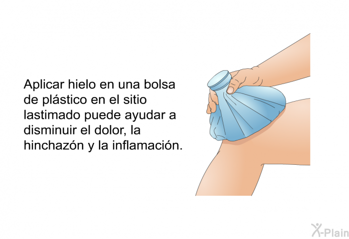 Aplicar hielo en una bolsa de plstico en el sitio lastimado puede ayudar a disminuir el dolor, la hinchazn y la inflamacin.
