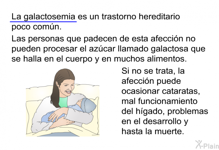 La galactosemia es un trastorno hereditario poco comn. Las personas que padecen de esta afeccin no pueden procesar el azcar llamado galactosa que se halla en el cuerpo y en muchos alimentos. Si no se trata, la afeccin puede ocasionar cataratas, mal funcionamiento del hgado, problemas en el desarrollo y hasta la muerte.
