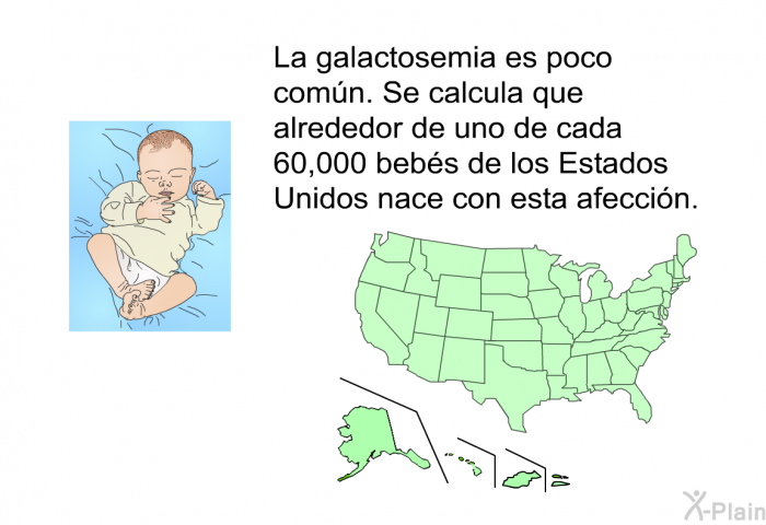La galactosemia es poco comn. Se calcula que alrededor de uno de cada 60,000 bebs de los Estados Unidos nace con esta afeccin.
