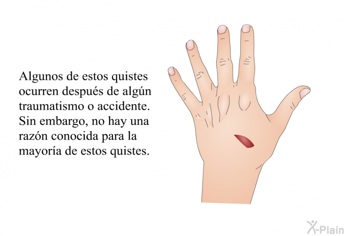 Algunos de estos quistes ocurren despus de algn traumatismo o accidente. Sin embargo, no hay una razn conocida para la mayora de estos quistes.