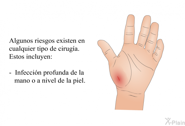 Algunos riesgos existen en cualquier tipo de ciruga. Estos incluyen:  Infeccin profunda de la mano o a nivel de la piel.