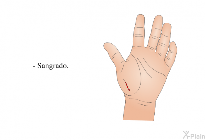 Sangrado.
