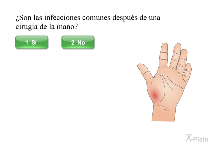 ¿Son las infecciones comunes despus de una ciruga de la mano?
