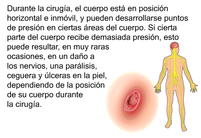 Durante la ciruga, el cuerpo est en posicin horizontal e inmvil, y pueden desarrollarse puntos de presin en ciertas reas del cuerpo. Si cierta parte del cuerpo recibe demasiada presin, esto puede resultar, en muy raras ocasiones, en un dao a los nervios, una parlisis, ceguera y lceras en la piel, dependiendo de la posicin de su cuerpo durante la ciruga.