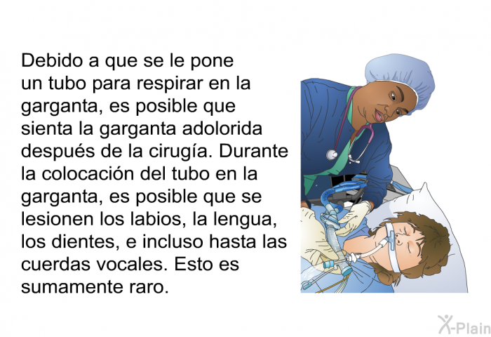 Debido a que se le pone un tubo para respirar en la garganta, es posible que sienta la garganta adolorida despus de la ciruga. Durante la colocacin del tubo en la garganta, es posible que se lesionen los labios, la lengua, los dientes, e incluso hasta las cuerdas vocales. Esto es sumamente raro.