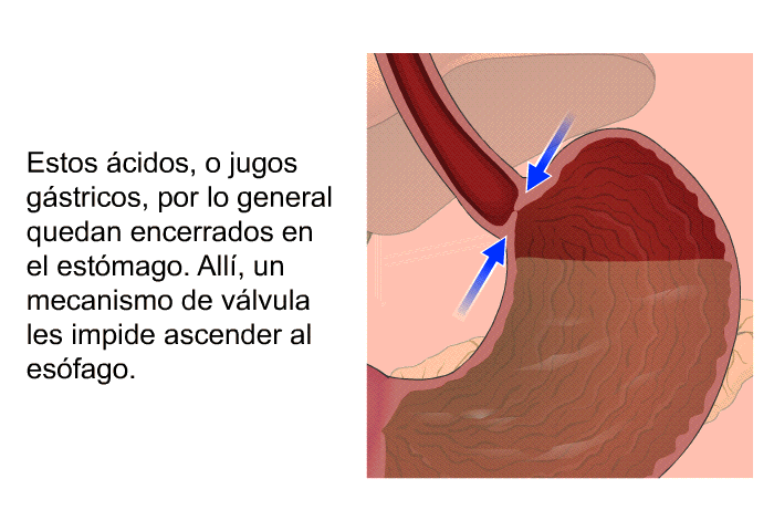 Estos cidos, o jugos gstricos, por lo general quedan encerrados en el estmago. All, un mecanismo de vlvula les impide ascender al esfago.