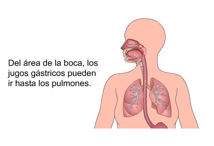 Del rea de la boca, los jugos gstricos pueden ir hasta los pulmones.