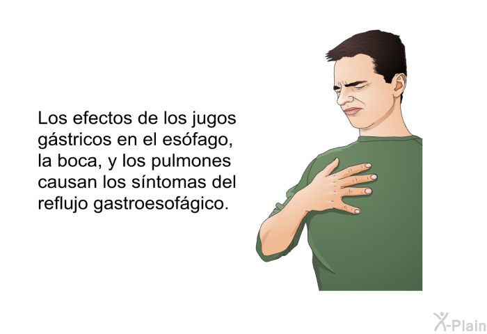 Los efectos de los jugos gstricos en el esfago, la boca, y los pulmones causan los sntomas del reflujo gastroesofgico.