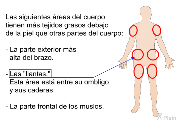 Las siguientes reas del cuerpo tienen ms tejidos grasos debajo de la piel que otras partes del cuerpo:  La parte exterior ms alta del brazo. Las “llantas.” Esta rea est entre su ombligo y sus caderas. La parte frontal de los muslos.