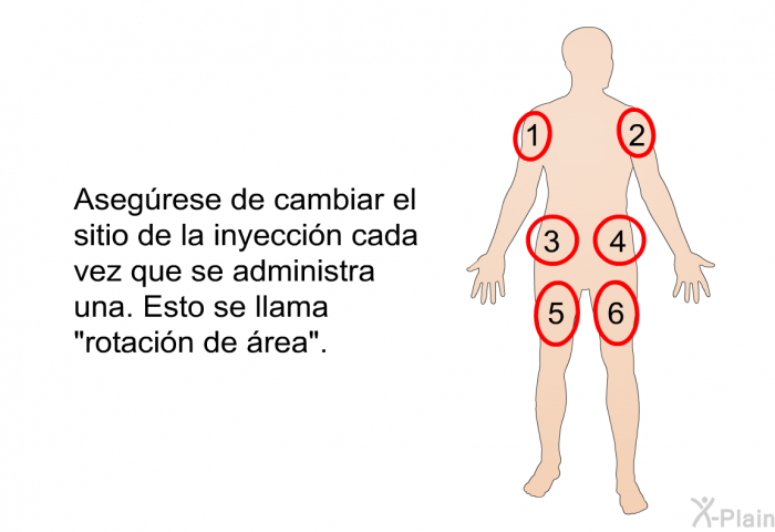 Asegrese de cambiar el sitio de la inyeccin cada vez que se administra una. Esto se llama “rotacin de rea”.