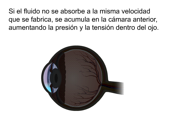 Si el fluido no se absorbe a la misma velocidad que se fabrica, se acumula en la cmara anterior, aumentando la presin y la tensin dentro del ojo.