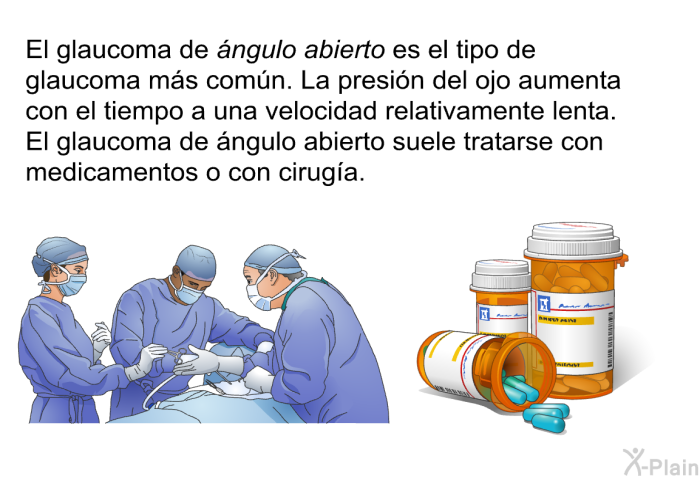 El glaucoma de <I>ngulo abierto</I> es el tipo de glaucoma ms comn. La presin del ojo aumenta con el tiempo a una velocidad relativamente lenta. El glaucoma de ngulo abierto suele tratarse con medicamentos o con ciruga.