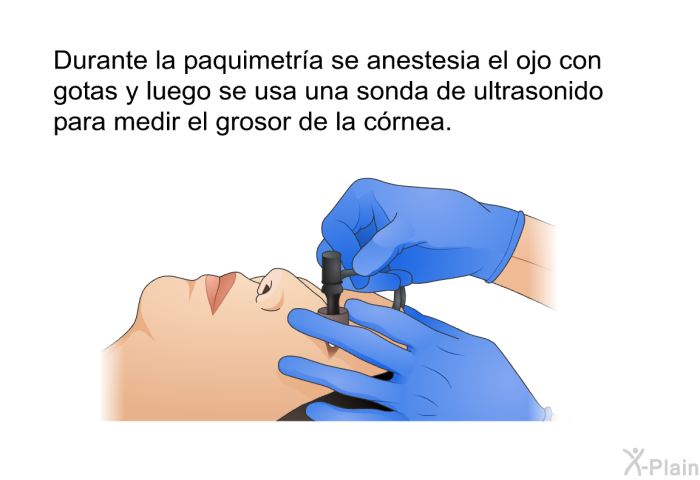 Durante la paquimetra se anestesia el ojo con gotas y luego se usa una sonda de ultrasonido para medir el grosor de la crnea.