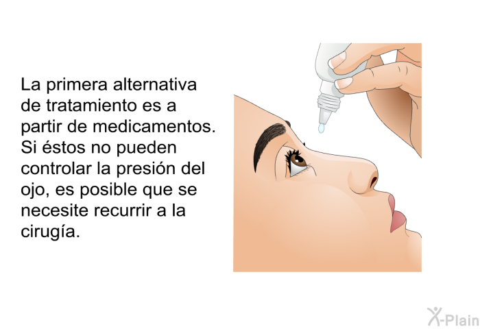 La primera alternativa de tratamiento es a partir de medicamentos. Si stos no pueden controlar la presin del ojo, es posible que se necesite recurrir a la ciruga.