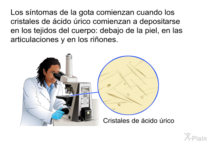 Los s�ntomas de la gota comienzan cuando los cristales de �cido �rico comienzan a depositarse en los tejidos del cuerpo: debajo de la piel, en las articulaciones y en los ri�ones.