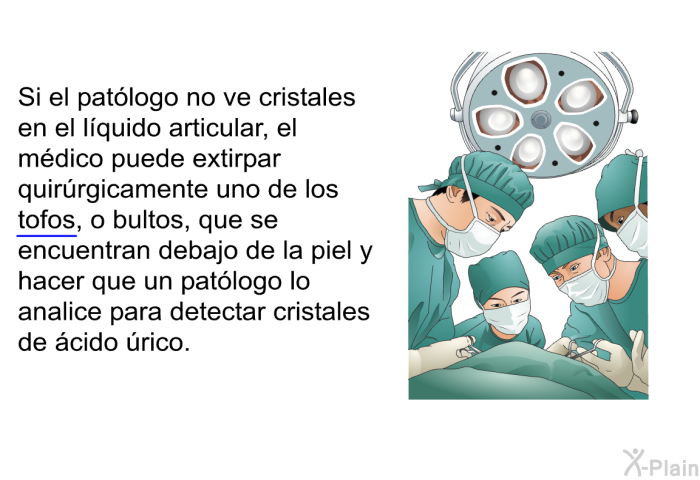 Si el patlogo no ve cristales en el lquido articular, el mdico puede extirpar quirrgicamente uno de los tofos, o bultos, que se encuentran debajo de la piel y hacer que un patlogo lo analice para detectar cristales de cido rico.