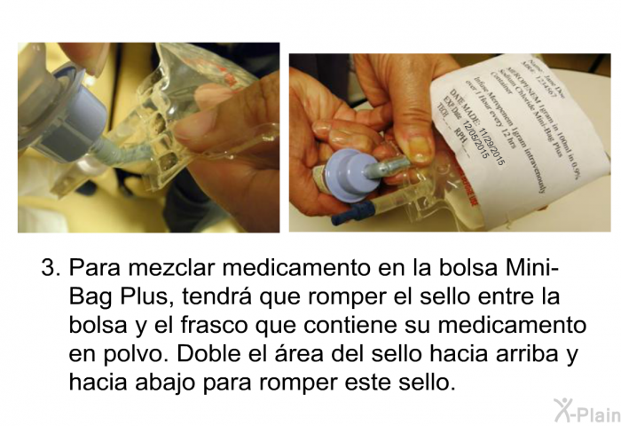 Para mezclar medicamento en la bolsa Mini-Bag Plus, tendr que romper el sello entre la bolsa y el frasco que contiene su medicamento en polvo. Doble el rea del sello hacia arriba y hacia abajo para romper este sello.