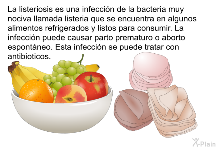 La listeriosis es una infeccin de la bacteria muy nociva llamada listeria que se encuentra en algunos alimentos refrigerados y listos para consumir. La infeccin puede causar parto prematuro o aborto espontneo. Esta infeccin se puede tratar con antibioticos.