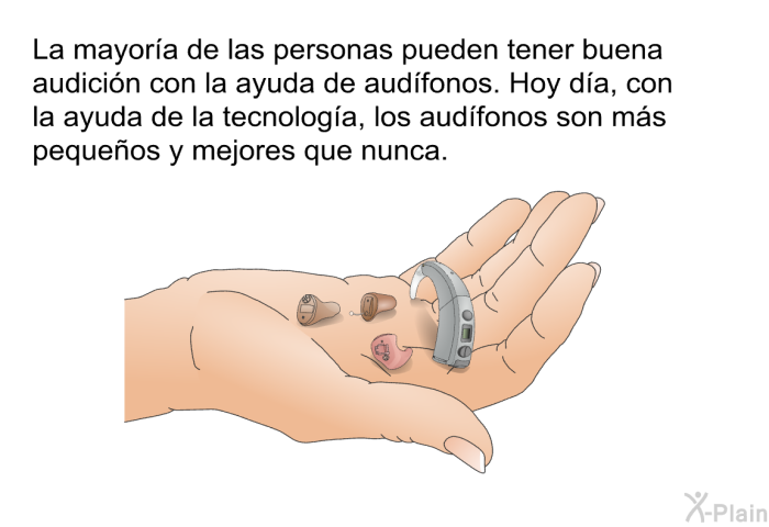 La mayora de las personas pueden tener buena audicin con la ayuda de audfonos. Hoy da, con la ayuda de la tecnologa, los audfonos son ms pequeos y mejores que nunca.