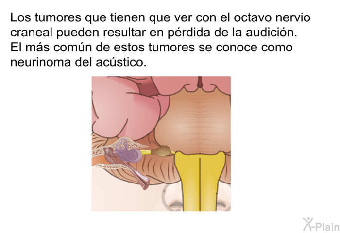 Los tumores que tienen que ver con el octavo nervio craneal pueden resultar en prdida de la audicin. El ms comn de estos tumores se conoce como neurinoma del acstico.