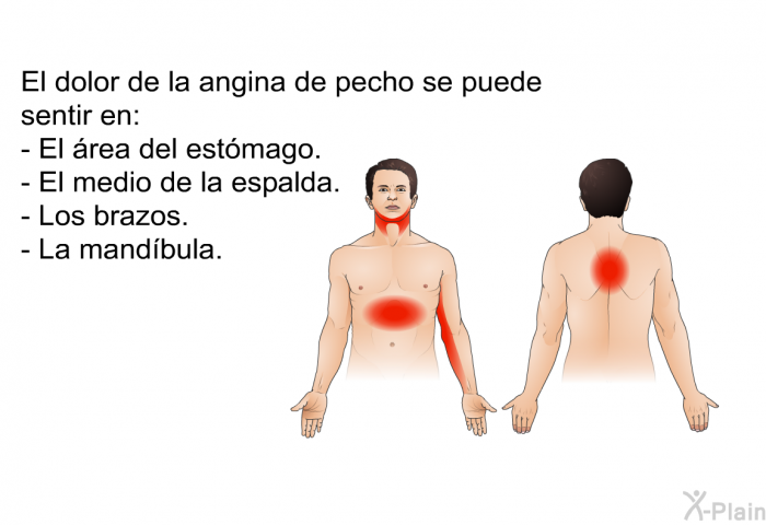 El dolor de la angina de pecho se puede sentir en:  El rea del estmago. El medio de la espalda. Los brazos. La mandbula.