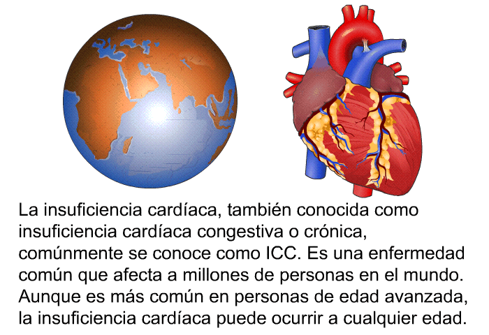 La insuficiencia cardaca, tambin conocida como insuficiencia cardaca congestiva o crnica, comnmente se conoce como ICC. Es una enfermedad comn que afecta a millones de personas en el mundo. Aunque es ms comn en personas de edad avanzada, la insuficiencia cardaca puede ocurrir a cualquier edad.