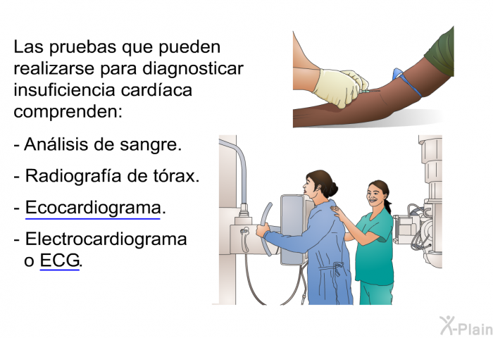 Las pruebas que pueden realizarse para diagnosticar insuficiencia cardaca comprenden:  Anlisis de sangre. Radiografa de trax. Ecocardiograma. Electrocardiograma o ECG.