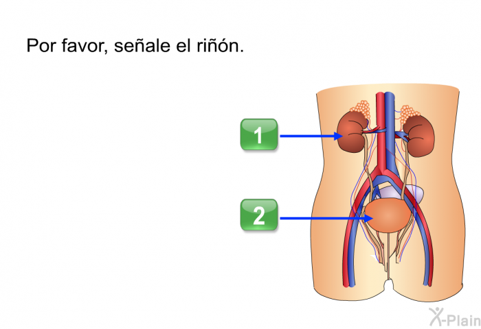 Por favor, seale el rin.