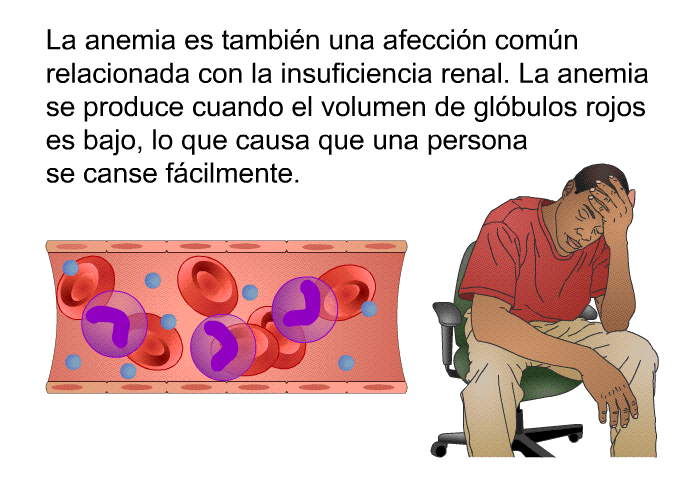 La anemia es tambin una afeccin comn relacionada con la insuficiencia renal. La anemia se produce cuando el volumen de glbulos rojos es bajo, lo que causa que una persona se canse fcilmente.