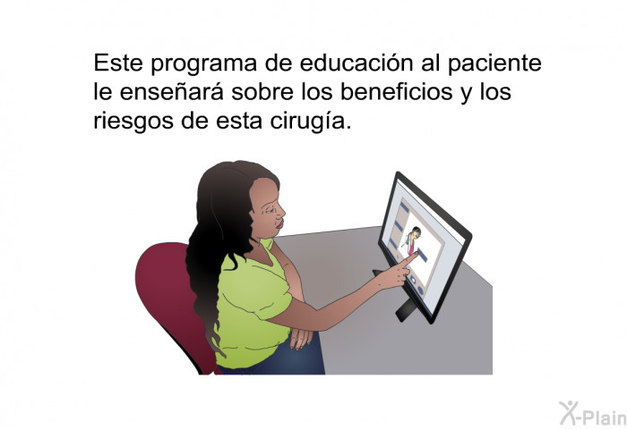 Esta informacin acerca de su salud le ensear sobre los beneficios y los riesgos de esta ciruga.