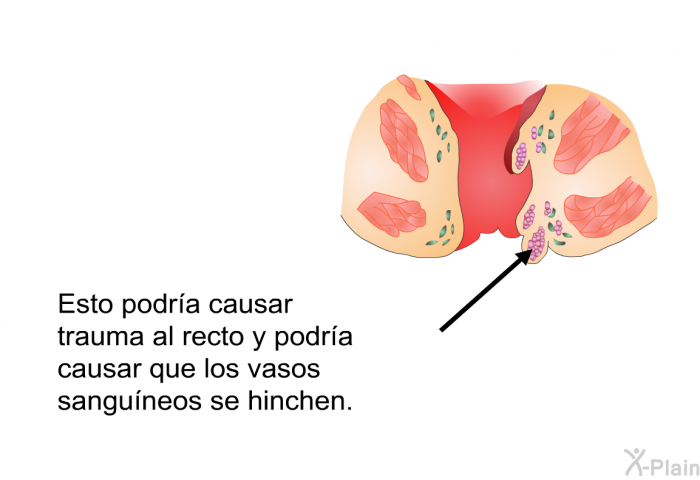 Esto podra causar trauma al recto y podra causar que los vasos sanguneos se hinchen.