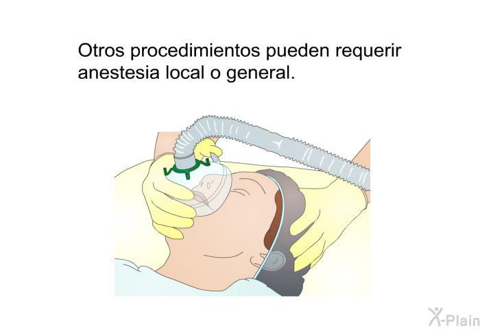 Otros procedimientos pueden requerir anestesia local o general.
