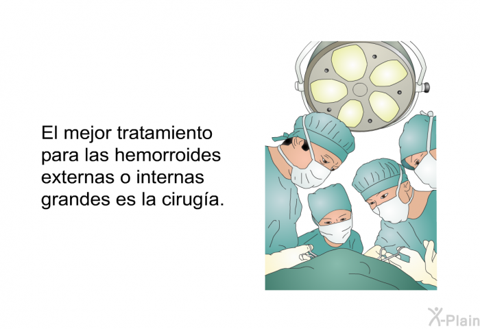El mejor tratamiento para las hemorroides externas o internas grandes es la ciruga.